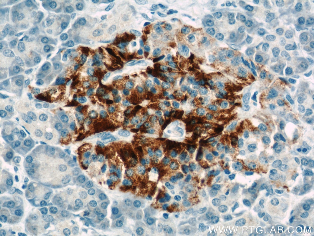 Immunohistochemistry (IHC) staining of human pancreas tissue using TMP21 Polyclonal antibody (15199-1-AP)
