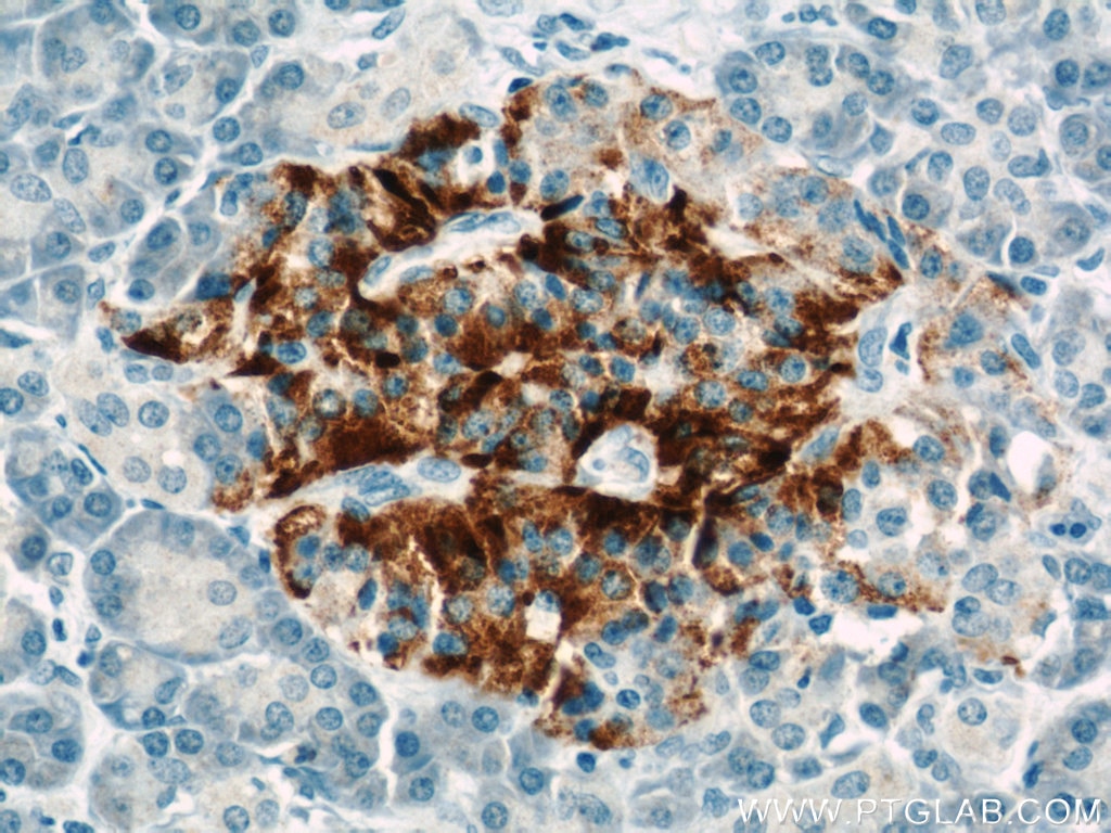 IHC staining of human pancreas using 15199-1-AP