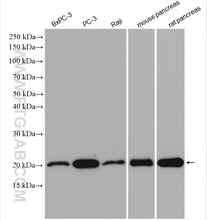 Western Blot (WB) analysis of various lysates using TMP21 Polyclonal antibody (15199-1-AP)