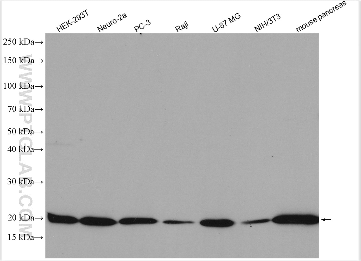 Western Blot (WB) analysis of various lysates using TMP21 Polyclonal antibody (15199-1-AP)