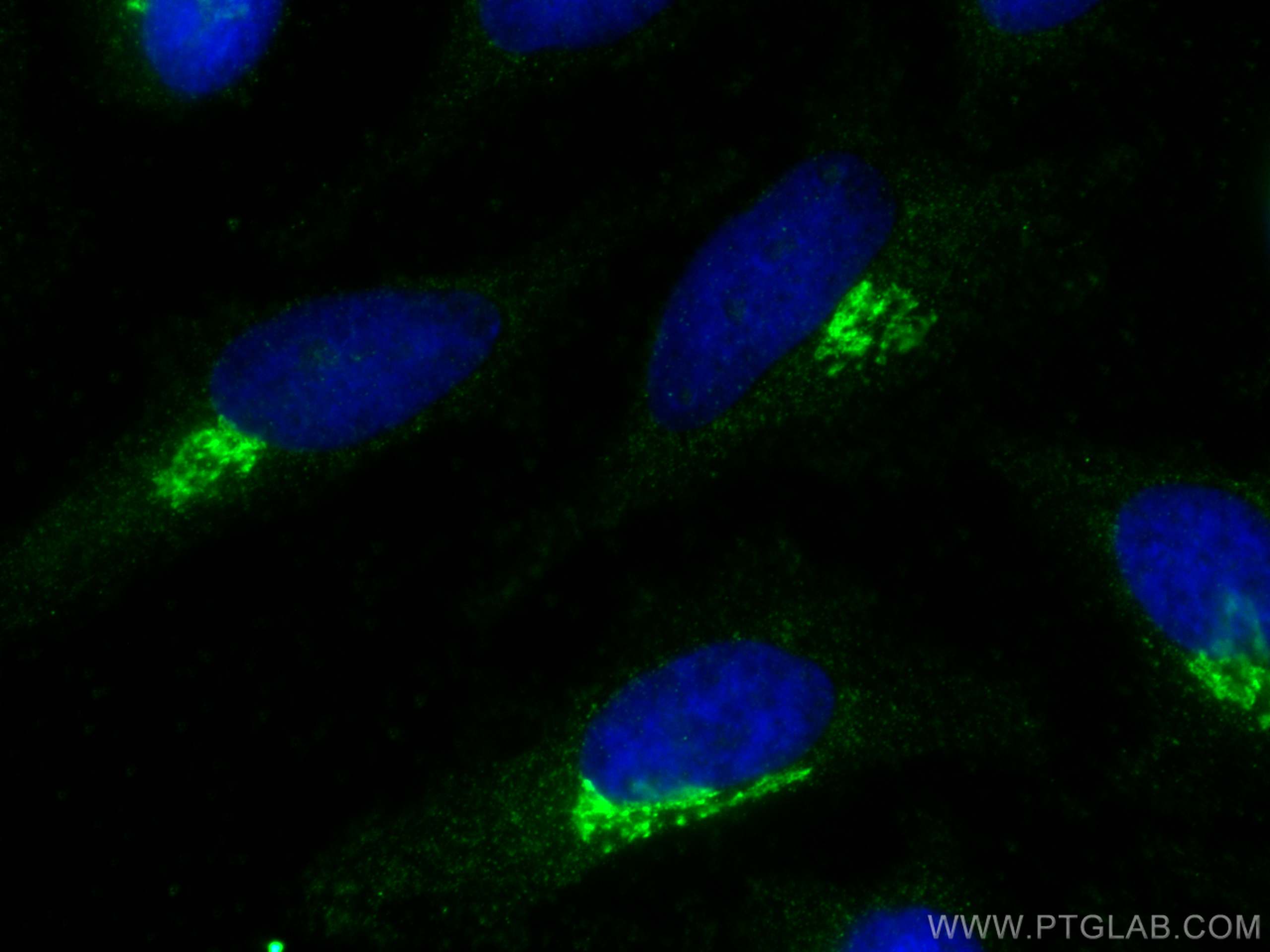 Immunofluorescence (IF) / fluorescent staining of HeLa cells using TMED10 Monoclonal antibody (67876-1-Ig)