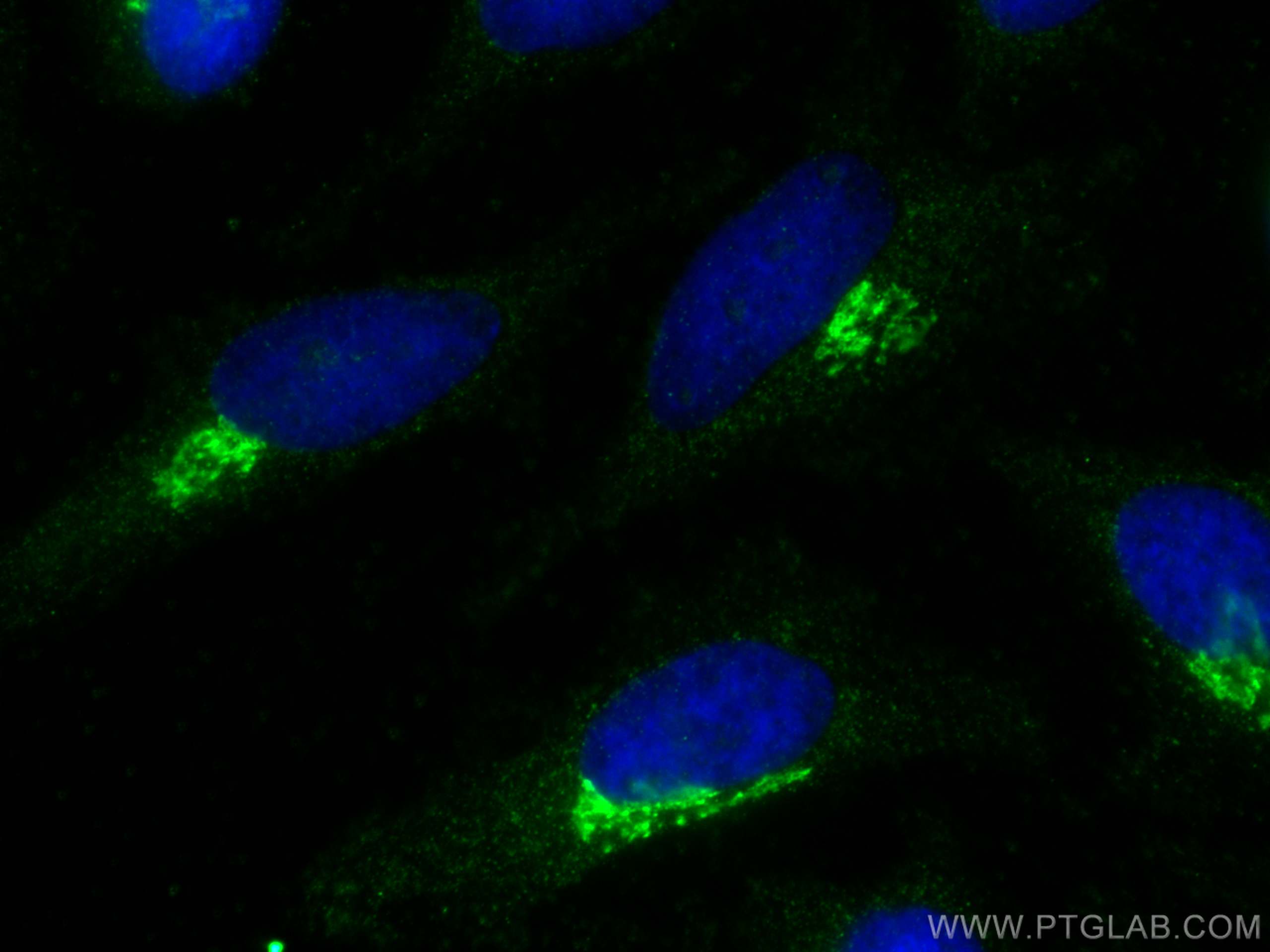 IF Staining of HeLa using 67876-1-Ig