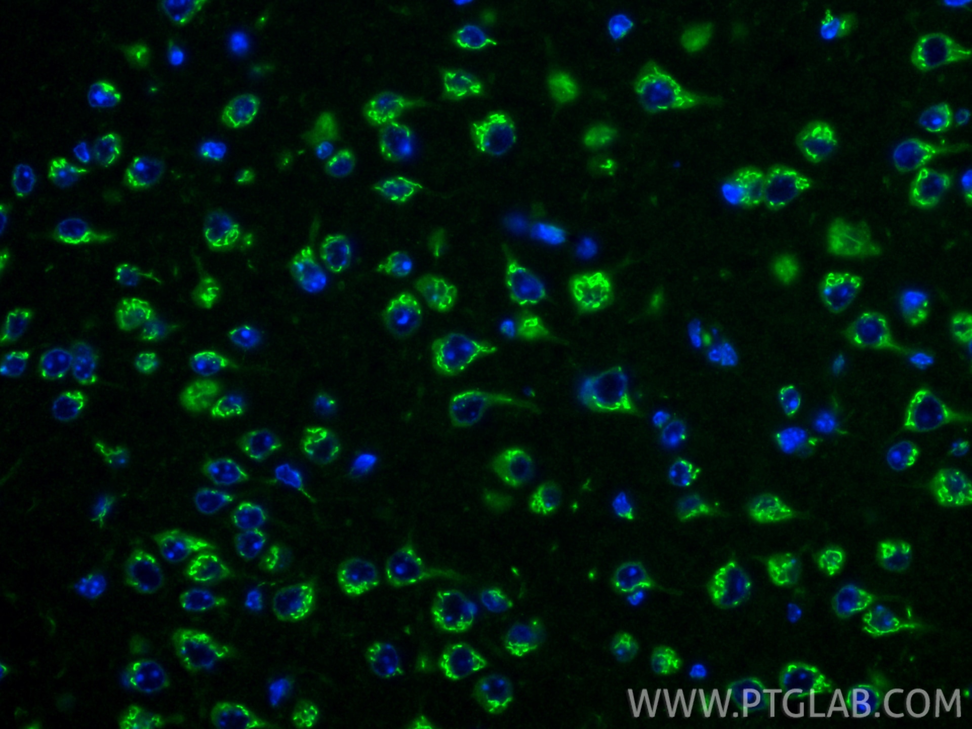 Immunofluorescence (IF) / fluorescent staining of mouse brain tissue using TMP21 Monoclonal antibody (67876-1-Ig)