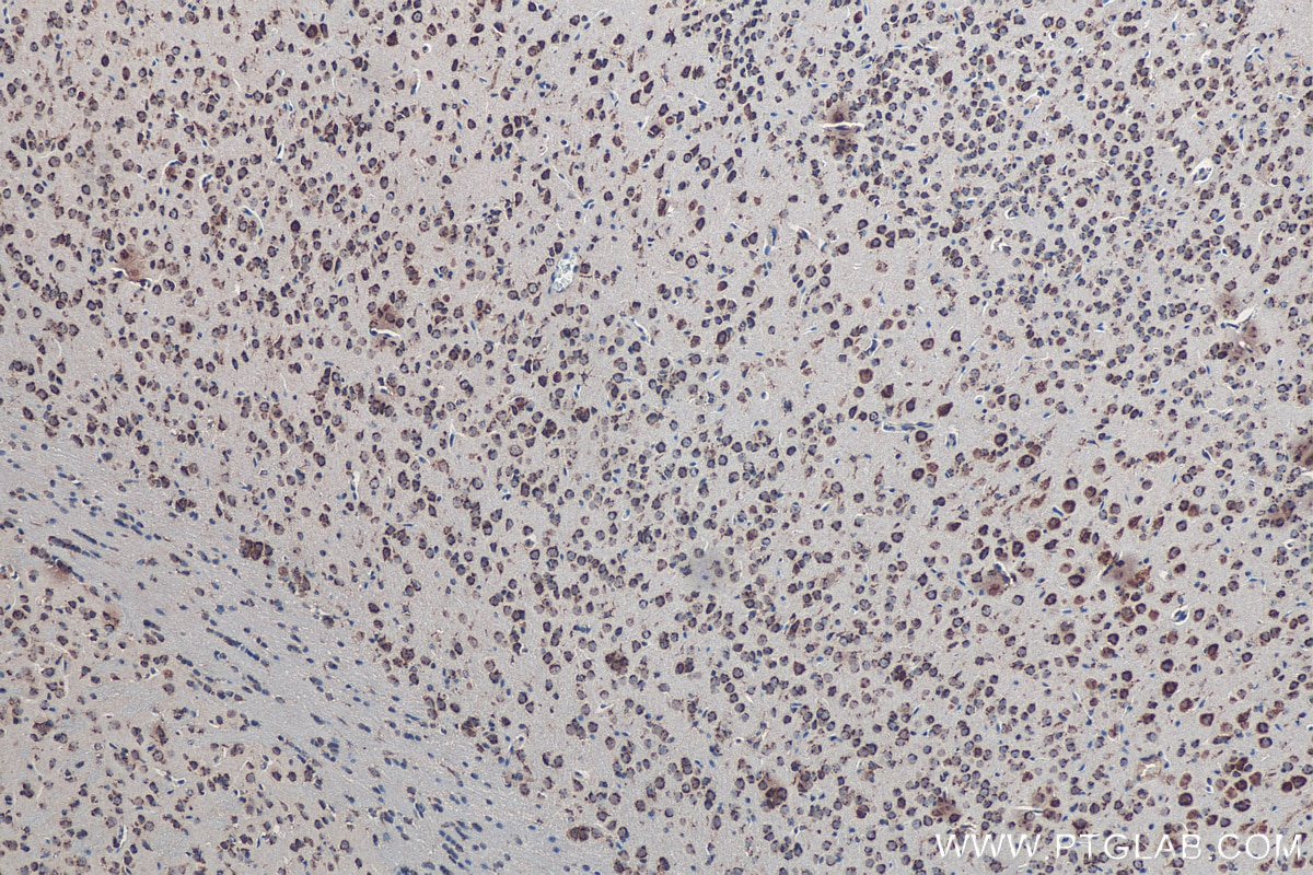 Immunohistochemistry (IHC) staining of mouse brain tissue using TMED10 Monoclonal antibody (67876-1-Ig)