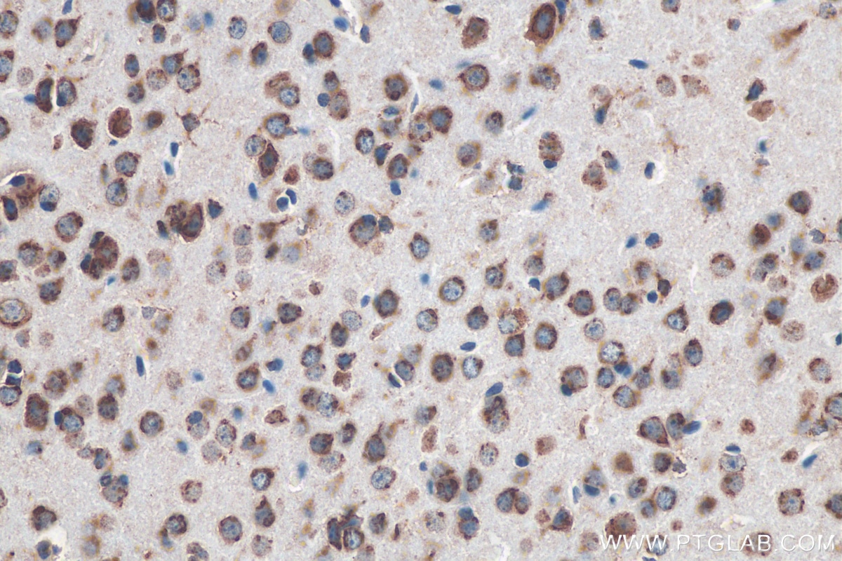 Immunohistochemistry (IHC) staining of mouse brain tissue using TMED10 Monoclonal antibody (67876-1-Ig)