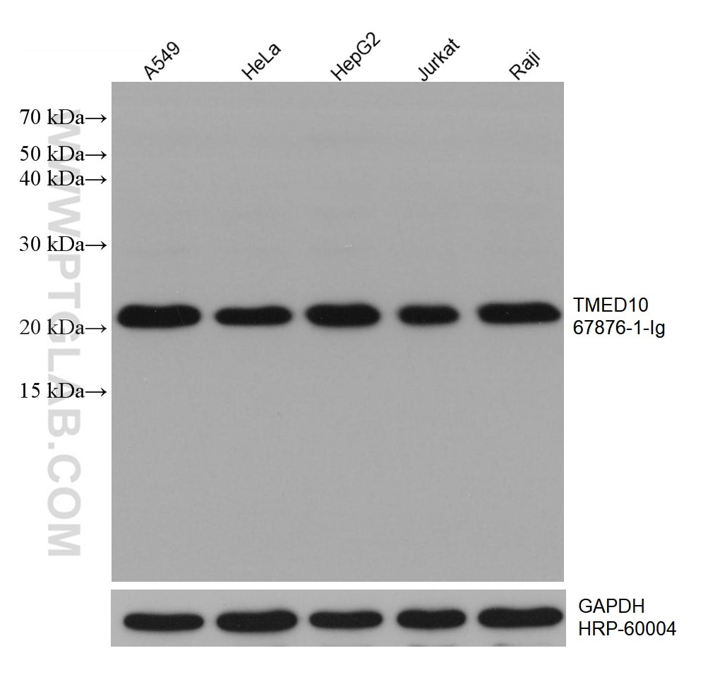 Western Blot (WB) analysis of various lysates using TMED10 Monoclonal antibody (67876-1-Ig)