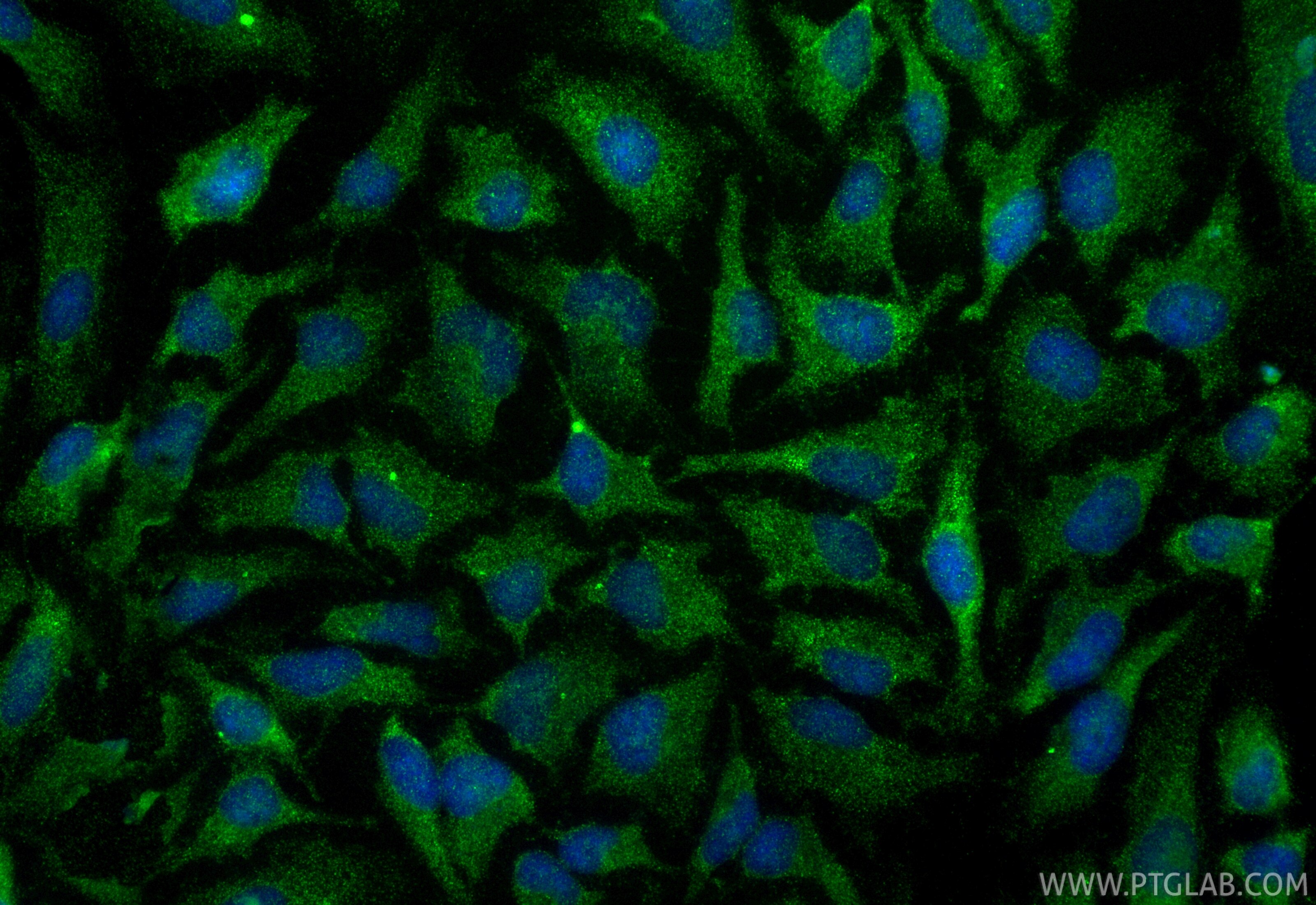 Immunofluorescence (IF) / fluorescent staining of HeLa cells using TMED2 Polyclonal antibody (11981-1-AP)