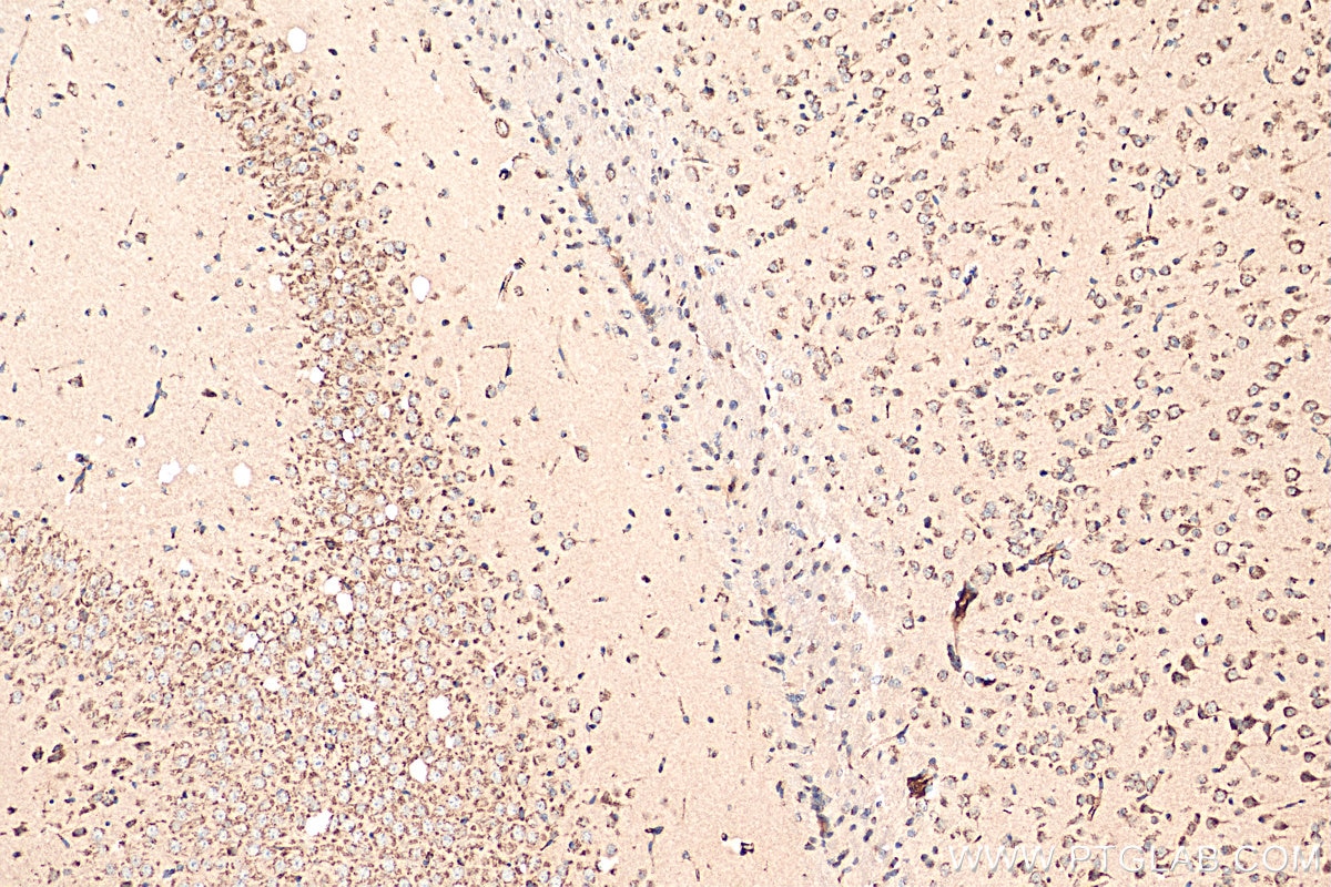 Immunohistochemistry (IHC) staining of mouse brain tissue using TMED2 Polyclonal antibody (11981-1-AP)