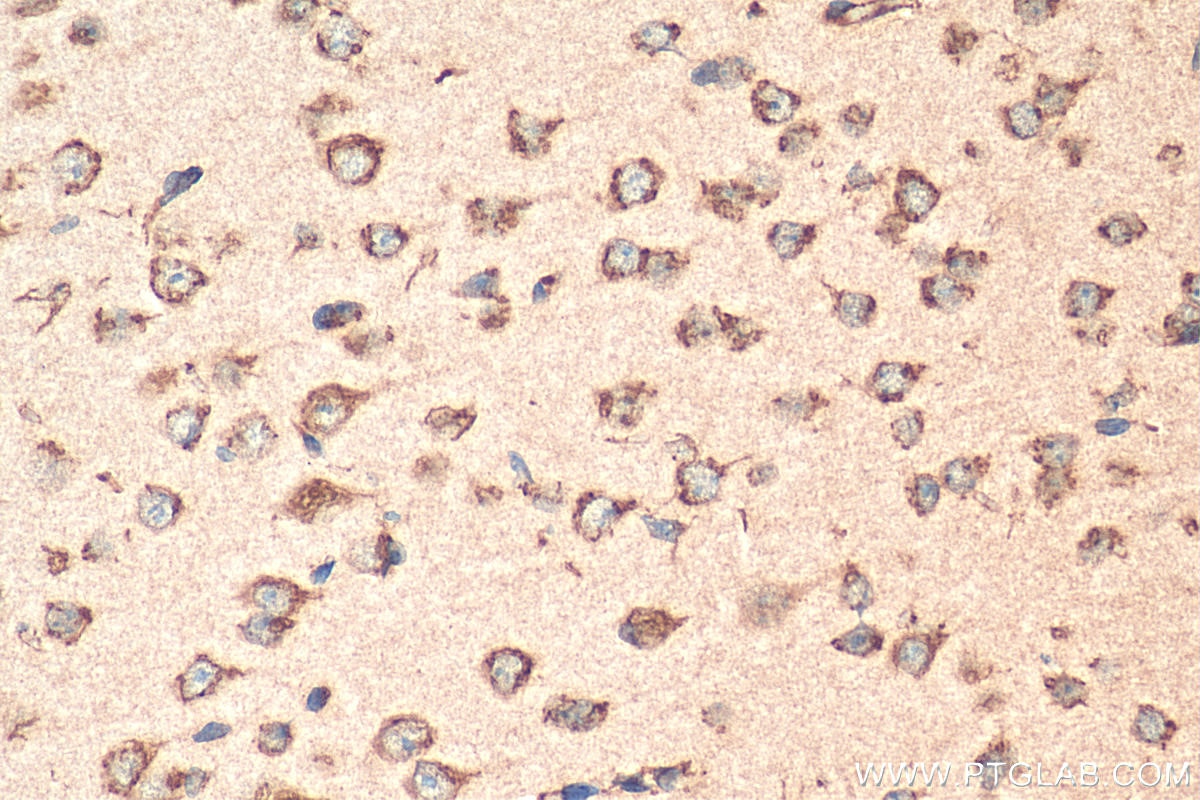 Immunohistochemistry (IHC) staining of mouse brain tissue using TMED2 Polyclonal antibody (11981-1-AP)