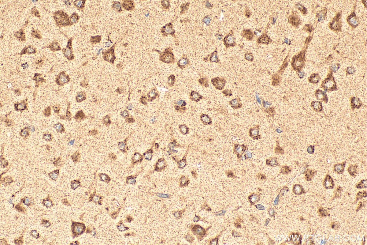 Immunohistochemical analysis of paraffin-embedded mouse brain tissue slide using 11981-1-AP (TMED2 antibody) at dilution of 1:1000 (under 40x lens). Heat mediated antigen retrieval with Tris-EDTA buffer (pH 9.0). Immunohistochemistry (IHC) staining of mouse brain tissue using TMED2 Polyclonal antibody (11981-1-AP)