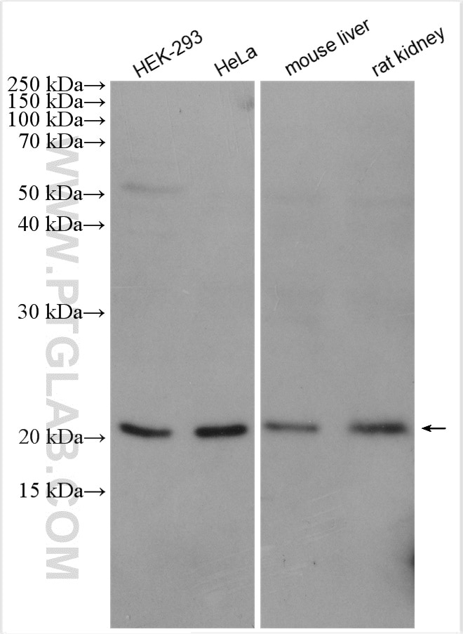 Western Blot (WB) analysis of various lysates using TMED2 Polyclonal antibody (11981-1-AP)