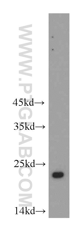 Western Blot (WB) analysis of mouse pancreas tissue using TMED2 Polyclonal antibody (11981-1-AP)