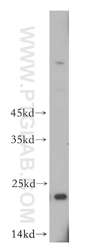 Western Blot (WB) analysis of mouse pancreas tissue using TMED2 Polyclonal antibody (11981-1-AP)