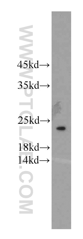 Western Blot (WB) analysis of mouse skin tissue using TMED2 Polyclonal antibody (11981-1-AP)