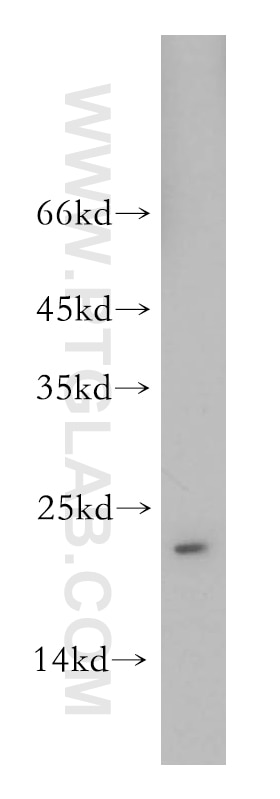 Western Blot (WB) analysis of mouse liver tissue using TMED2 Polyclonal antibody (11981-1-AP)