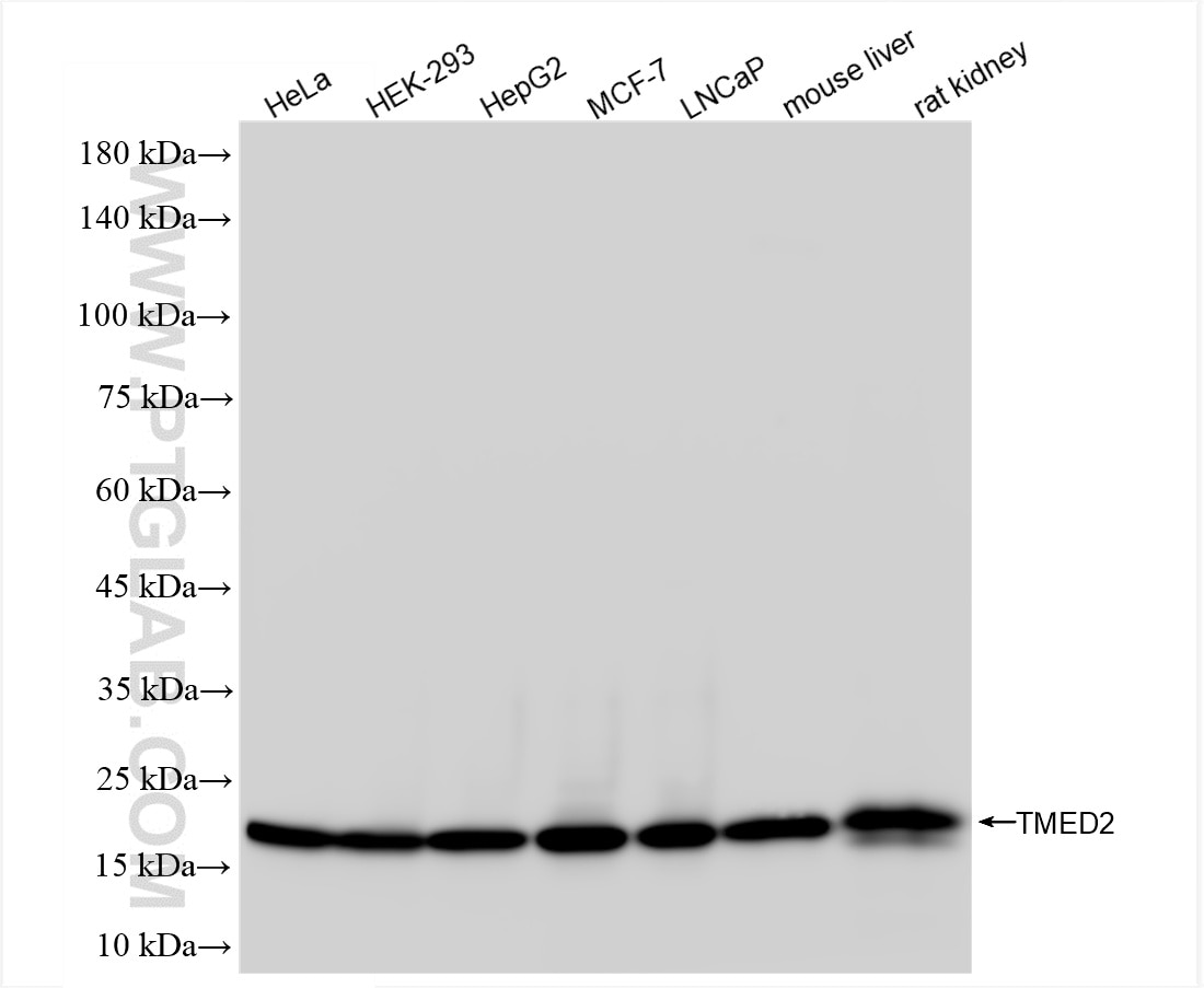 Western Blot (WB) analysis of various lysates using TMED2 Recombinant antibody (86172-1-RR)