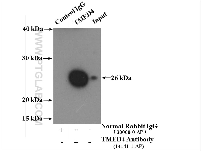 Immunoprecipitation (IP) experiment of mouse liver tissue using TMED4 Polyclonal antibody (14141-1-AP)
