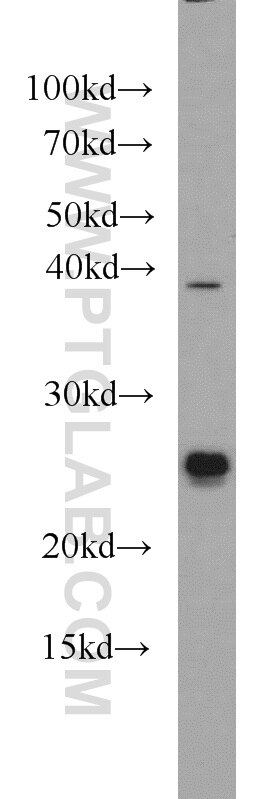 Western Blot (WB) analysis of mouse liver tissue using TMED4 Polyclonal antibody (14141-1-AP)