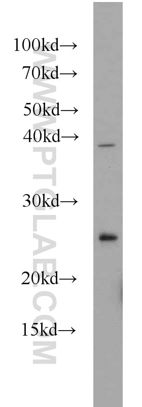 Western Blot (WB) analysis of mouse liver tissue using TMED4 Polyclonal antibody (14141-1-AP)