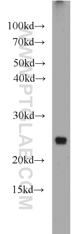Western Blot (WB) analysis of mouse liver tissue using TMED4 Polyclonal antibody (14141-1-AP)