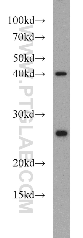 Western Blot (WB) analysis of HepG2 cells using TMED4 Polyclonal antibody (14141-1-AP)