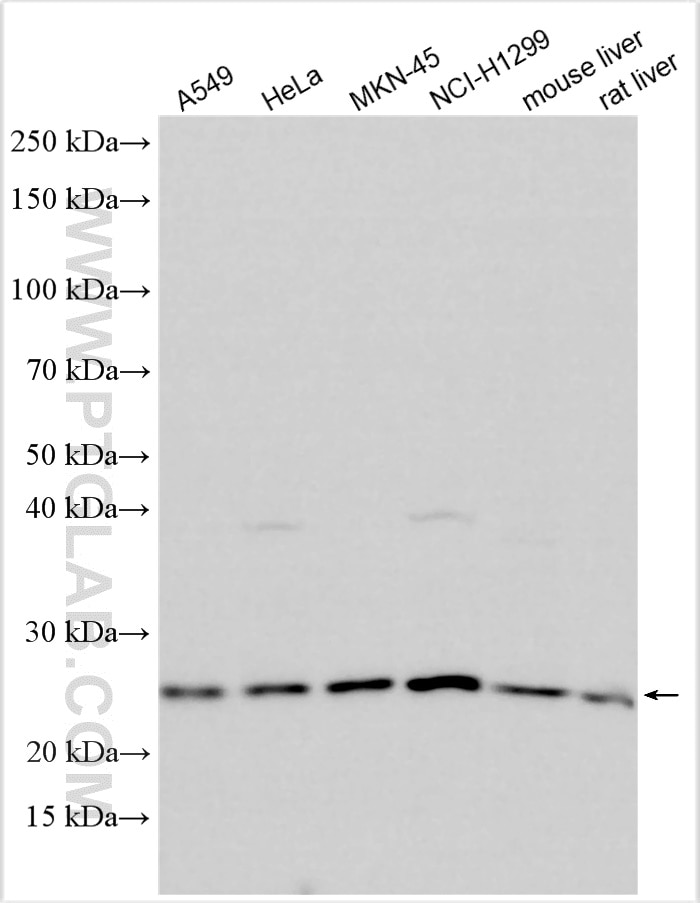 Western Blot (WB) analysis of various lysates using TMED5 Polyclonal antibody (30393-1-AP)
