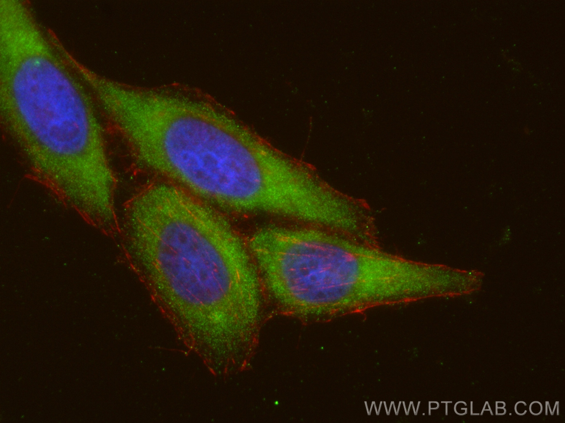 Immunofluorescence (IF) / fluorescent staining of HepG2 cells using TMED9 Polyclonal antibody (21620-1-AP)