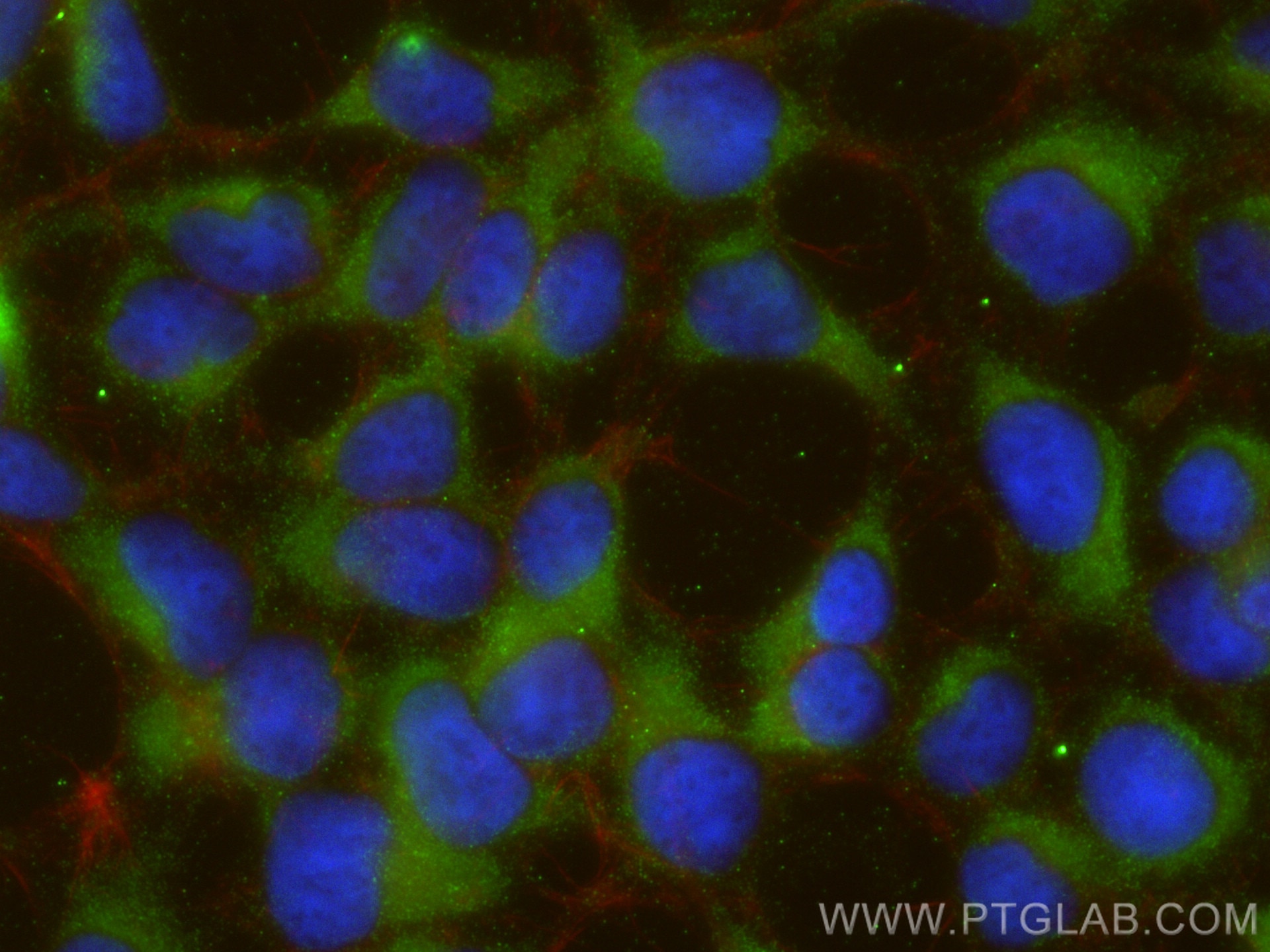 Immunofluorescence (IF) / fluorescent staining of HEK-293 cells using TMED9 Polyclonal antibody (21620-1-AP)