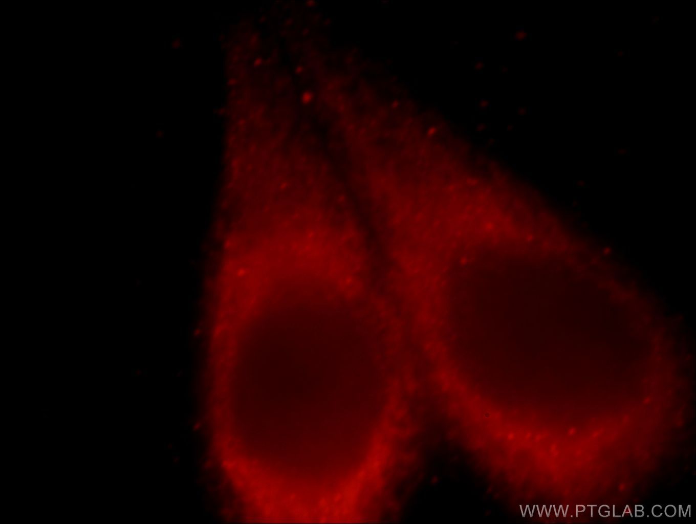 Immunofluorescence (IF) / fluorescent staining of HeLa cells using TMED9 Polyclonal antibody (21620-1-AP)