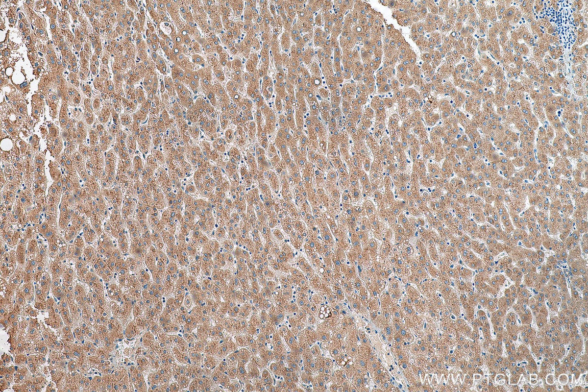 Immunohistochemistry (IHC) staining of human liver tissue using TMED9 Polyclonal antibody (21620-1-AP)