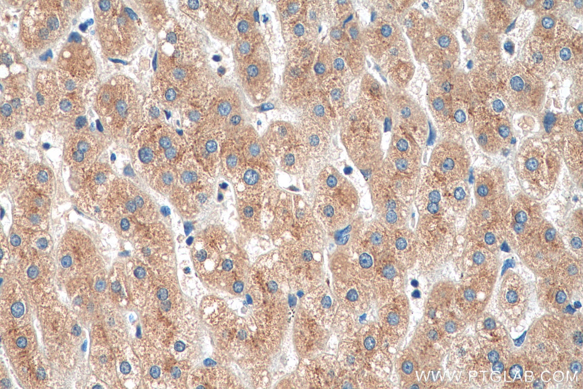 Immunohistochemistry (IHC) staining of human liver tissue using TMED9 Polyclonal antibody (21620-1-AP)