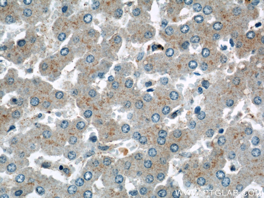 Immunohistochemistry (IHC) staining of human liver tissue using TMED9 Polyclonal antibody (21620-1-AP)