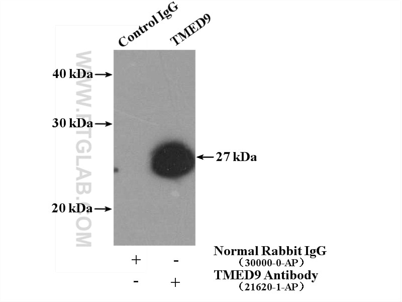 Immunoprecipitation (IP) experiment of mouse liver tissue using TMED9 Polyclonal antibody (21620-1-AP)
