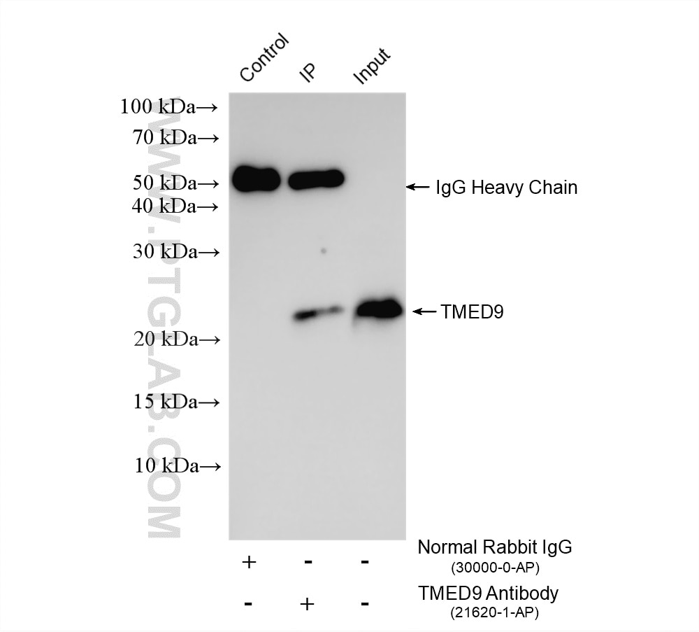 Immunoprecipitation (IP) experiment of HepG2 cells using TMED9 Polyclonal antibody (21620-1-AP)