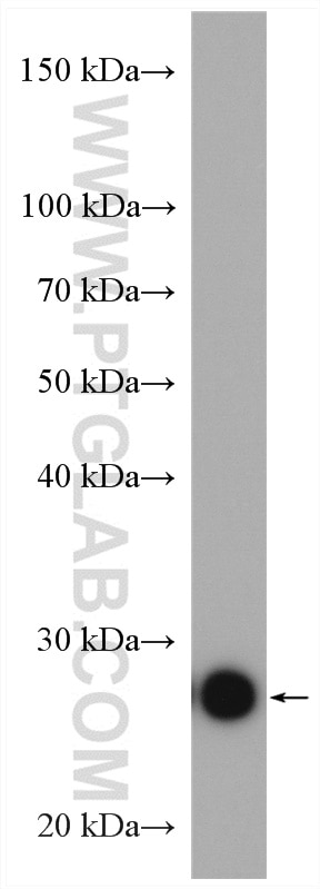 Western Blot (WB) analysis of mouse brain tissue using TMED9 Polyclonal antibody (21620-1-AP)