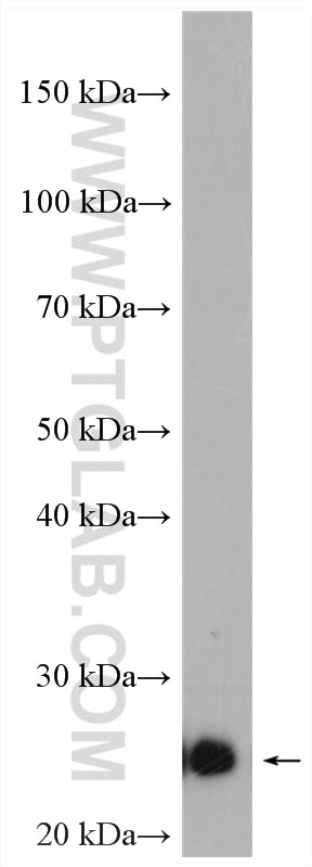 Western Blot (WB) analysis of mouse lung tissue using TMED9 Polyclonal antibody (21620-1-AP)
