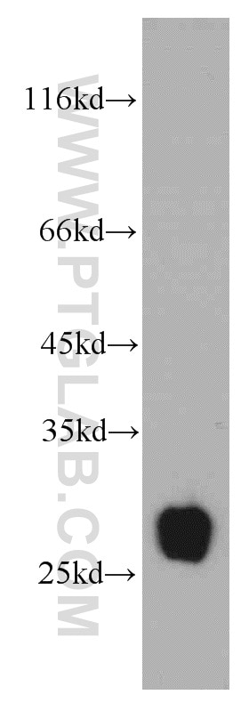 Western Blot (WB) analysis of mouse pancreas tissue using TMED9 Polyclonal antibody (21620-1-AP)