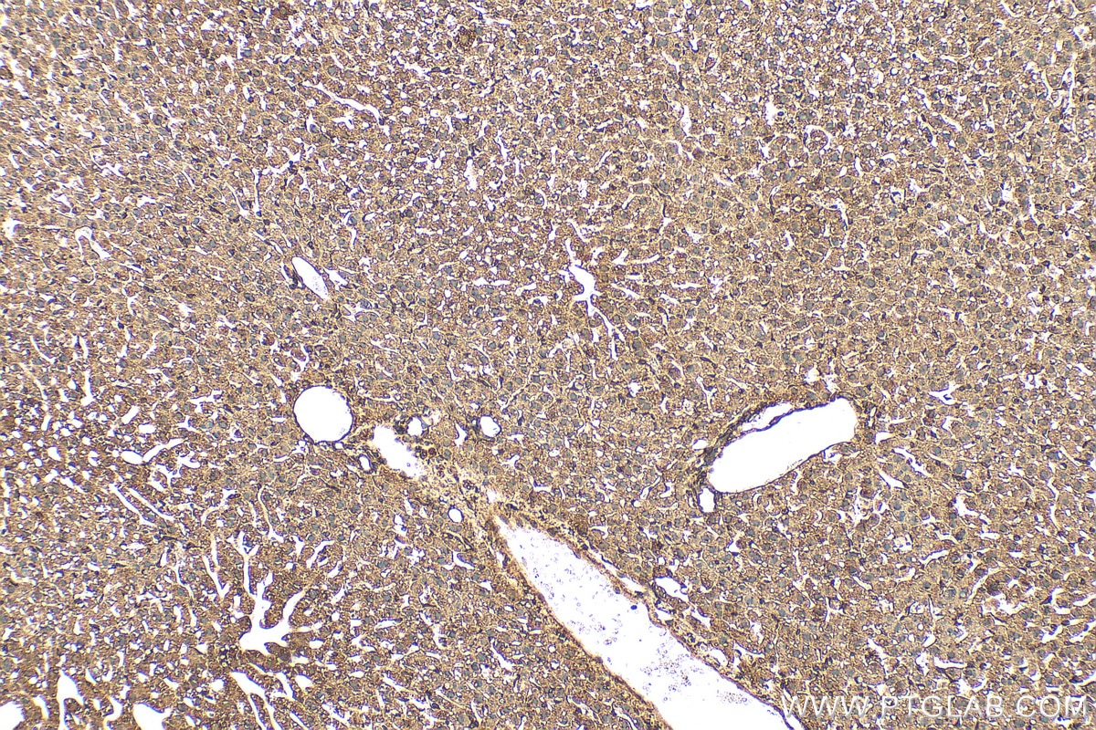 IHC staining of mouse liver using 60631-7-Ig Immunohistochemistry (IHC) staining of mouse liver tissue using TMED9 Monoclonal antibody (60631-7-Ig)