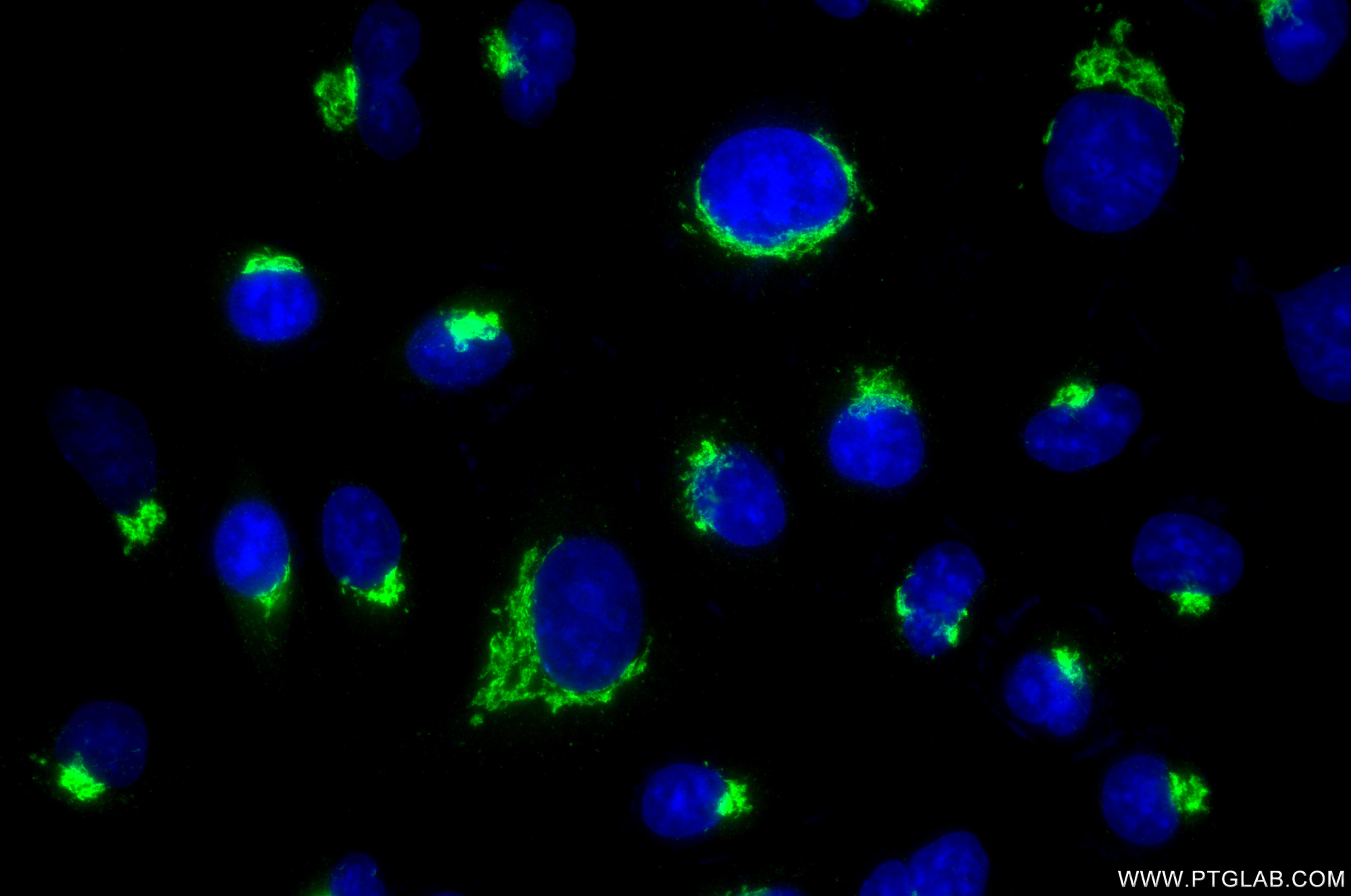 IF Staining of A549 using 86802-1-RR Immunofluorescence (IF) / fluorescent staining of A549 cells using TMED9 Recombinant monoclonal antibody (86802-1-RR)