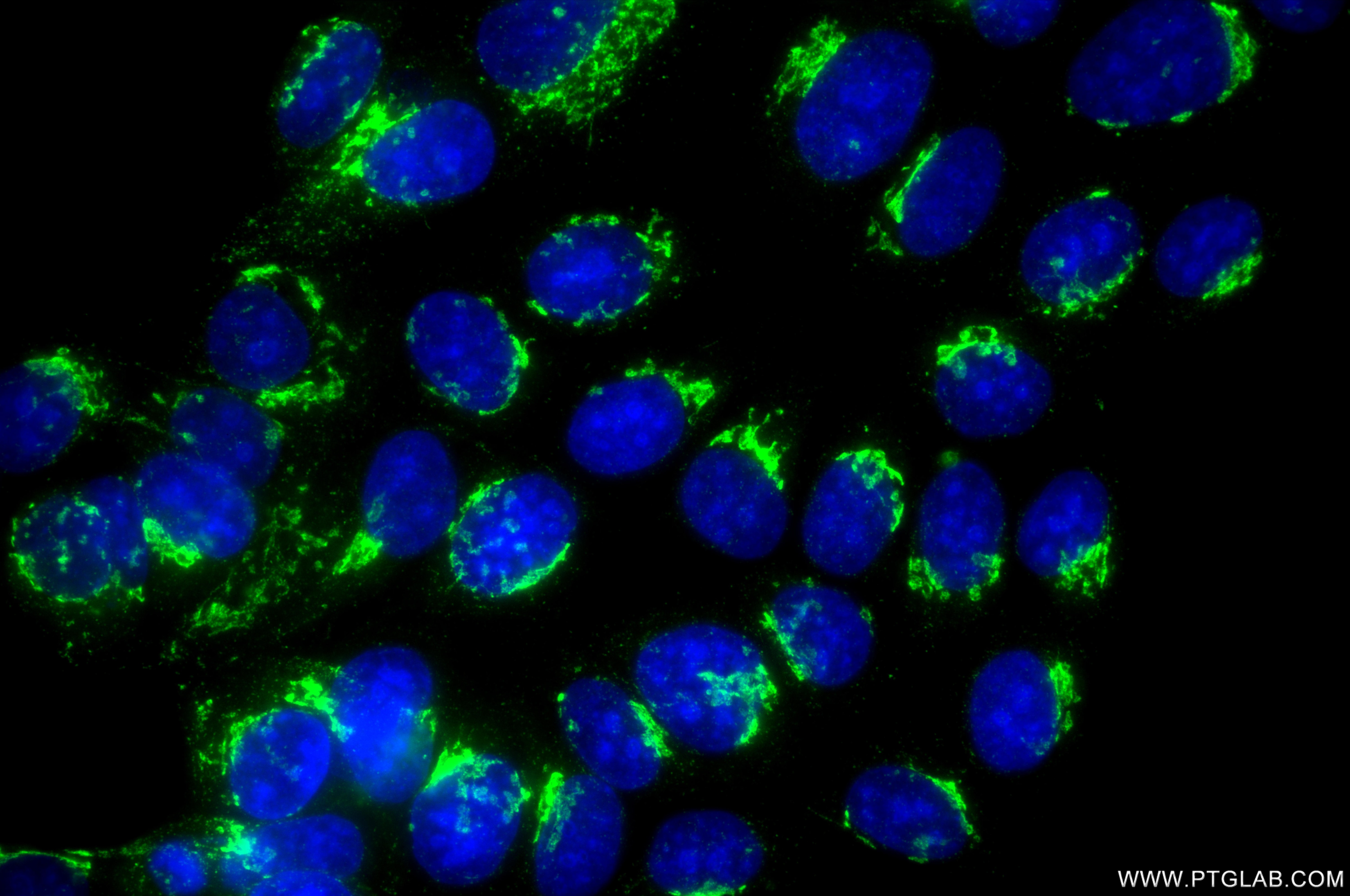 IF Staining of MCF-7 using 86802-1-RR Immunofluorescence (IF) / fluorescent staining of MCF-7 cells using TMED9 Recombinant monoclonal antibody (86802-1-RR)