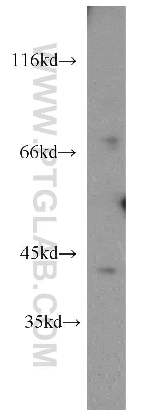 Western Blot (WB) analysis of human brain tissue using TMEFF2 Polyclonal antibody (11928-1-AP)