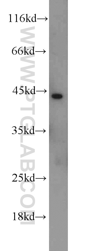 Western Blot (WB) analysis of HeLa cells using TMEFF2 Polyclonal antibody (11928-1-AP)