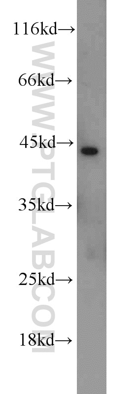 WB analysis of HeLa using 11928-1-AP