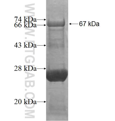 TMEFF2 fusion protein Ag2609 SDS-PAGE
