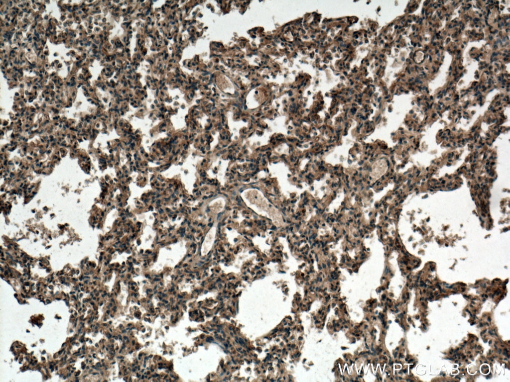 Immunohistochemistry (IHC) staining of human lung tissue using TMEM100 Polyclonal antibody (25581-1-AP)