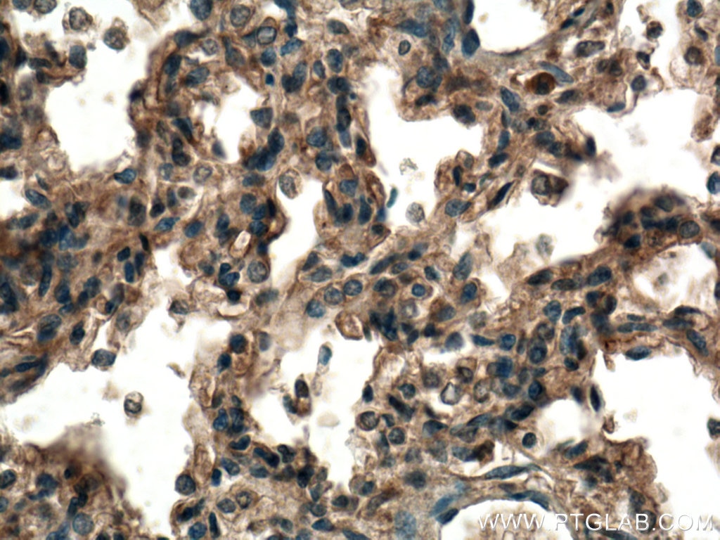 Immunohistochemistry (IHC) staining of human lung tissue using TMEM100 Polyclonal antibody (25581-1-AP)