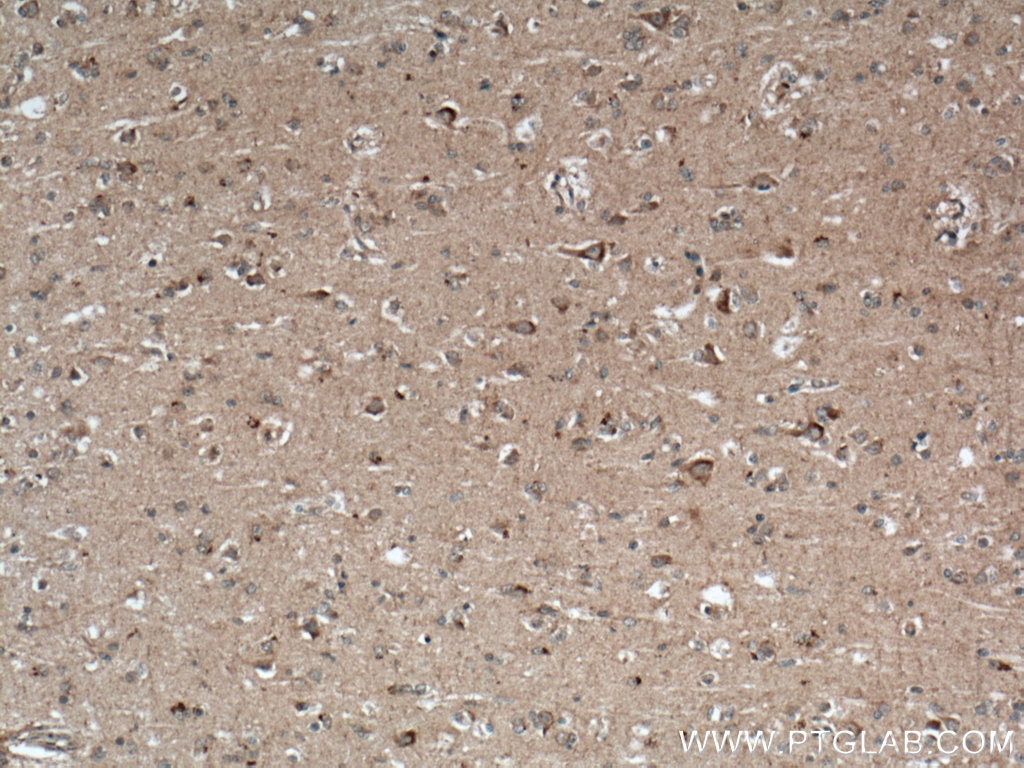 Immunohistochemistry (IHC) staining of human brain tissue using TMEM100 Polyclonal antibody (25581-1-AP)