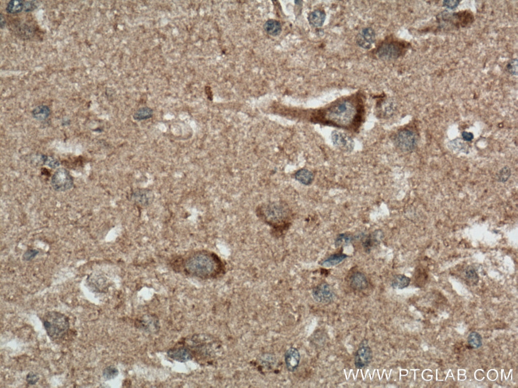 Immunohistochemistry (IHC) staining of human brain tissue using TMEM100 Polyclonal antibody (25581-1-AP)