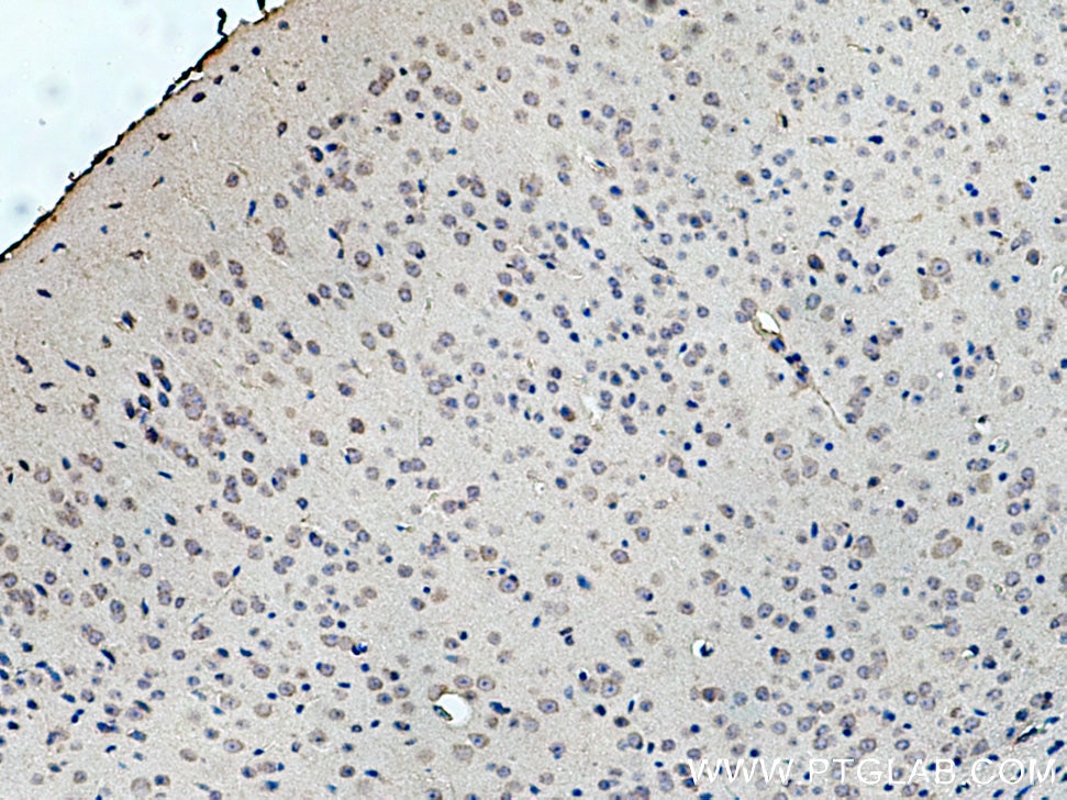 Immunohistochemistry (IHC) staining of mouse brain tissue using TMEM100 Polyclonal antibody (25581-1-AP)