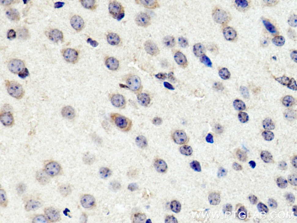 Immunohistochemistry (IHC) staining of mouse brain tissue using TMEM100 Polyclonal antibody (25581-1-AP)